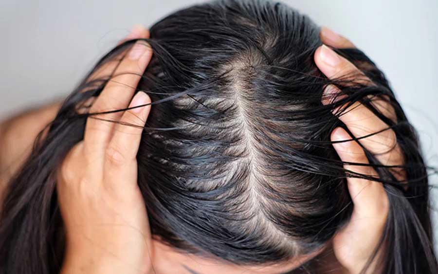 2407 Oily Scalp With Dry Ends.jpg