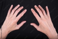 2407 Skinny female hands